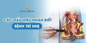 Dấu Hiệu Bệnh Trĩ Nhẹ