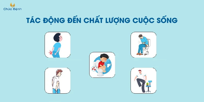 Dấu Hiệu Bệnh Trĩ Nhẹ