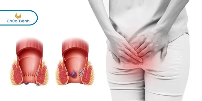 hướng dẫn điều trị tại nhà