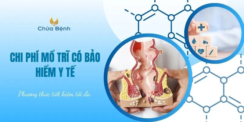 Chi phí mổ trĩ có bảo hiểm y tế